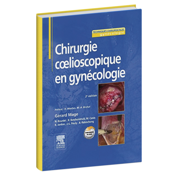 Chirurgie coelioscopique en gynécologie