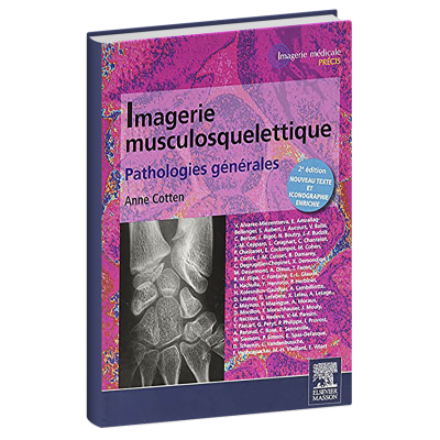 Imagerie musculosquelettique Pathologies générales Imagerie musculosquelettique Pathologies générales