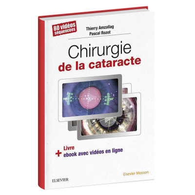 Chirurgie de la cataracte Chirurgie de la cataracte