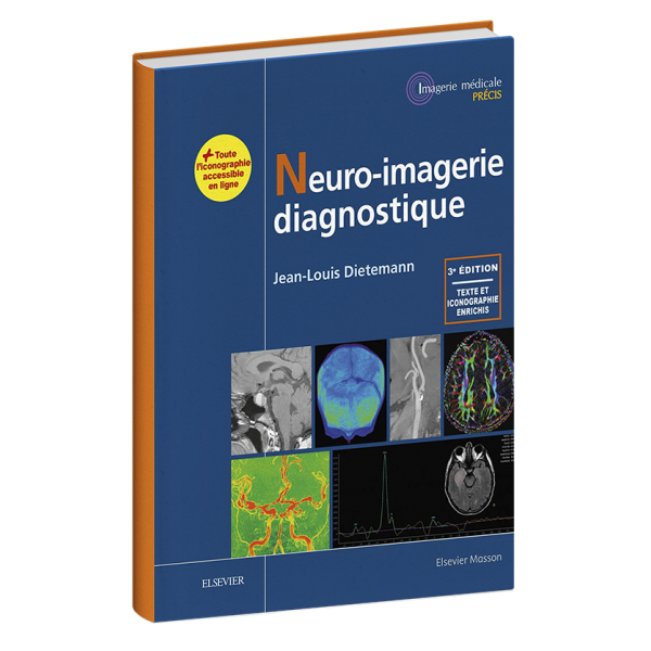 Neuro-imagerie diagnostique