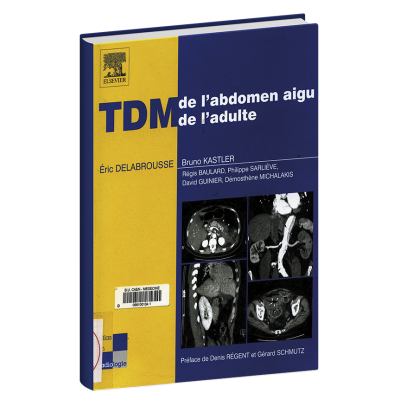 TDM de l'abdomen aigu de l'adulte TDM de l'abdomen aigu de l'adulte