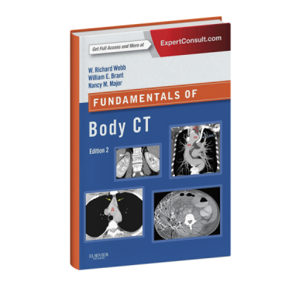 Fundamentals of body CT Fundamentals of body CT