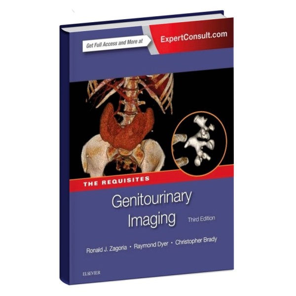 Genitourinary Imaging