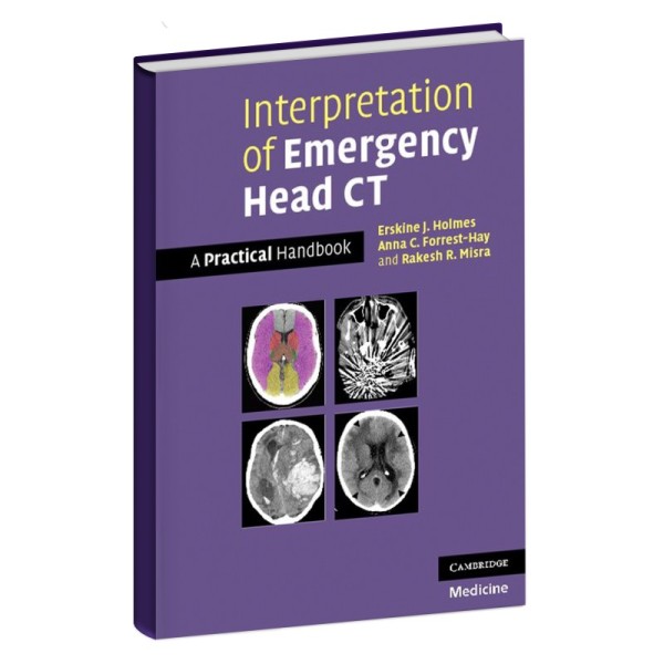 Interpretation of Emergency Head CT