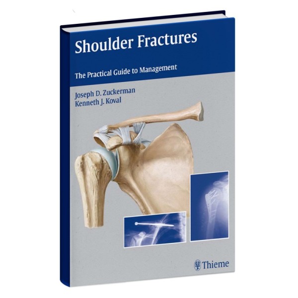 Shoulder-fractures-the-practical-guide-to-management