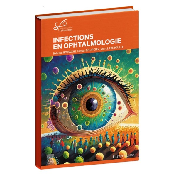 Infection-ophtalmologie