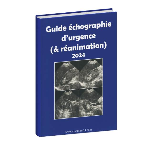 Guide échographie d'urgence (& réanimation) 2024
