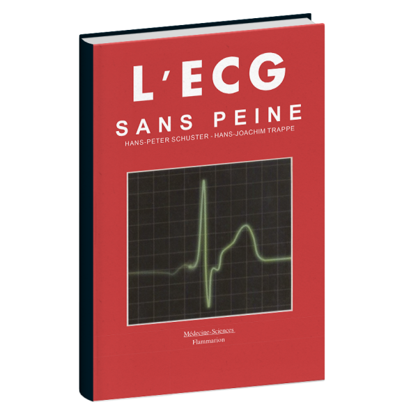 L ' E C G sans peine