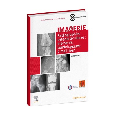 Imagerie Radiographies ostéoarticulaires: éléments sémiologiques à maitriser