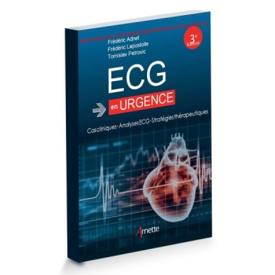 ECG en urgence Cas clinique Analyse ECG Stratégie thérapeutique ECG en urgence Cas clinique Analyse ECG Stratégie thérapeutique