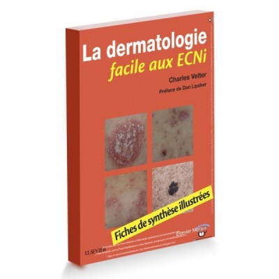 La dermatologie facile aux ECNi - Fiches de synthèse illustrées La dermatologie facile aux ECNi - Fiches de synthèse illustrées