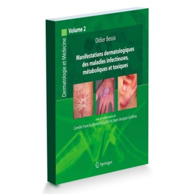 Manifestations dermatologiques des maladies infectieuses Volume 2 Manifestations dermatologiques des maladies infectieuses Volume 2