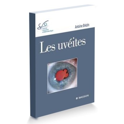 Les uvéites