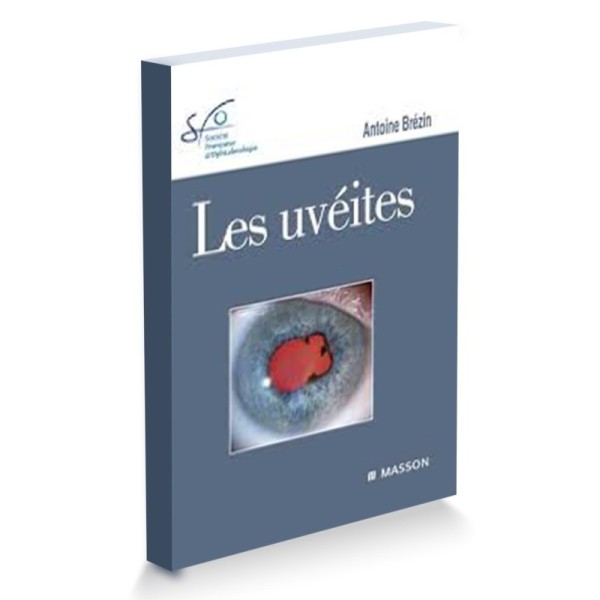 Les uvéites