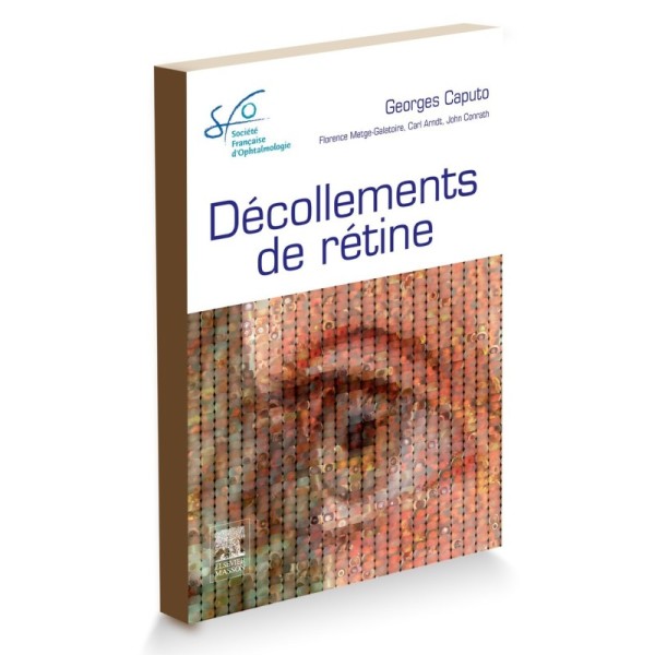 Décollements de rétine