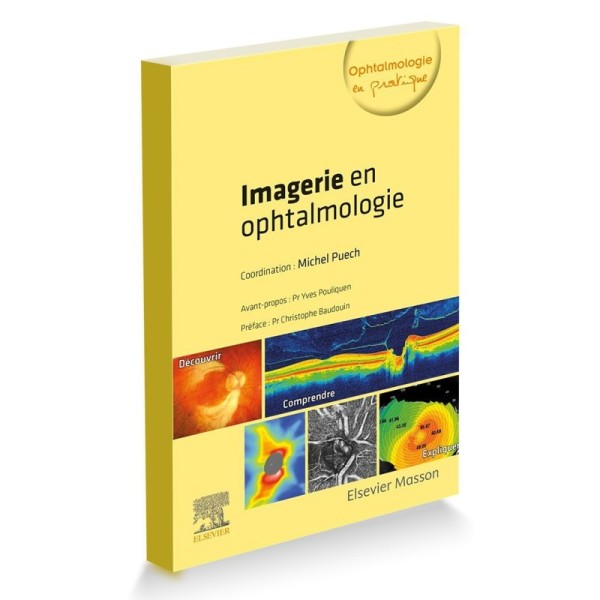 Imagerie en ophtalmologie