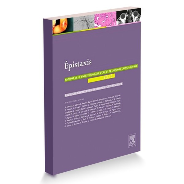 Épistaxis
