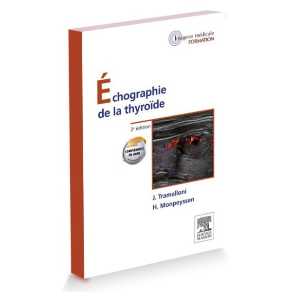 Echographie de la thyroïde
