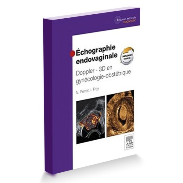 Echographie endovaginale doppler 3D