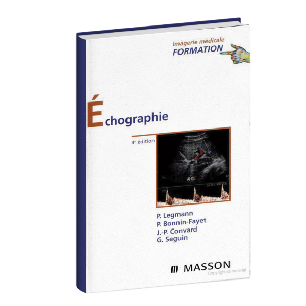 Echographie