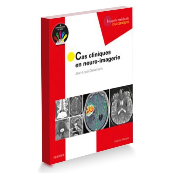 Cas cliniques en Neuro-imagerie