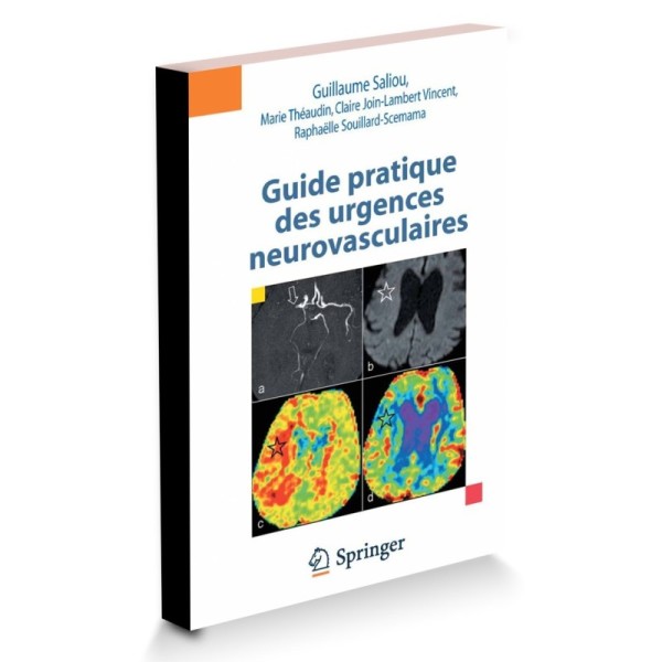 Guide pratique des urgences neurovasculaires