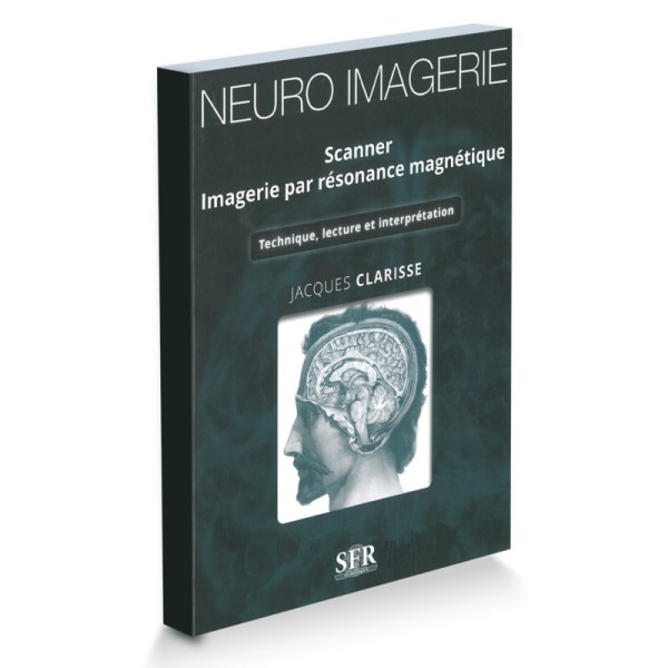 Neuro-imagerie Scanner IRM