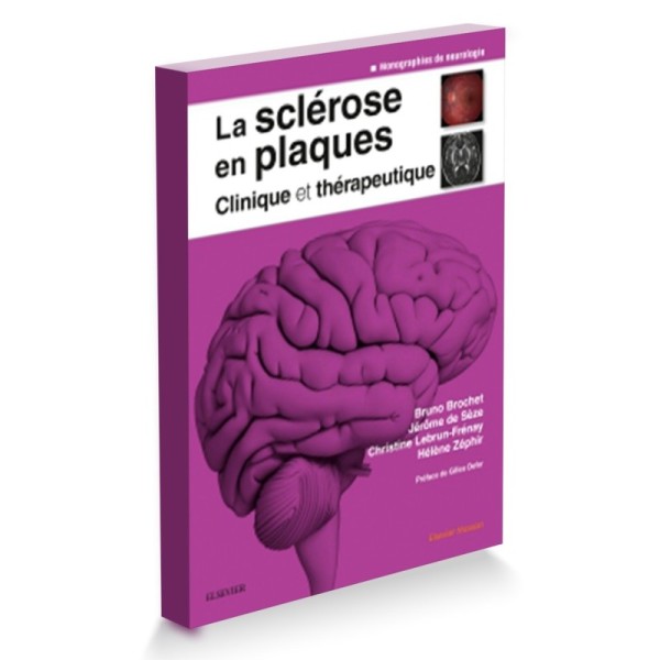 Sclérose en plaques - Clinique et thérapeutique