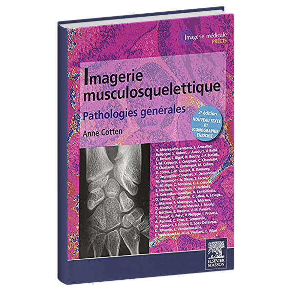 Imagerie musculosquelettique Pathologies générales