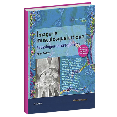 Imagerie musculosquelettique Pathologies locorégionales Imagerie musculosquelettique Pathologies locorégionales