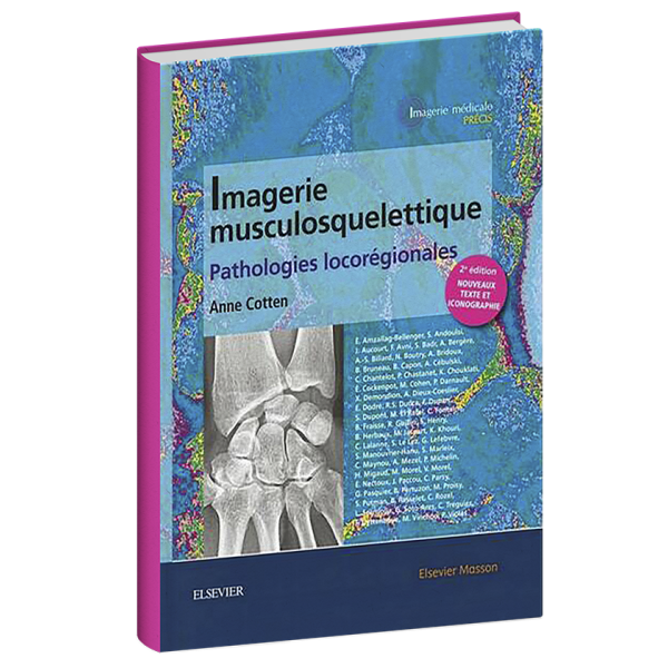 Imagerie musculosquelettique Pathologies locorégionales