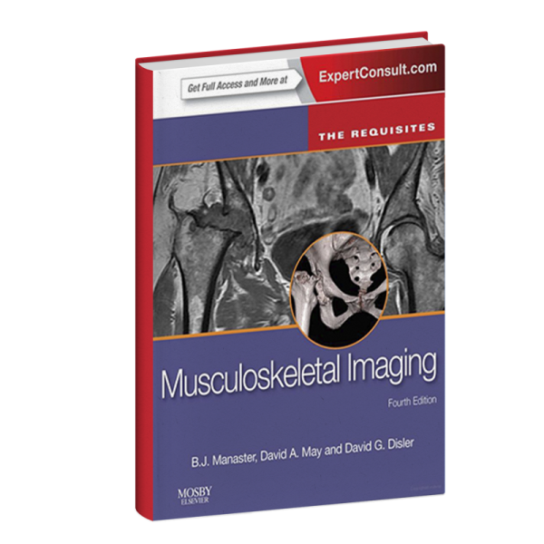 Musculoskeletal imaging