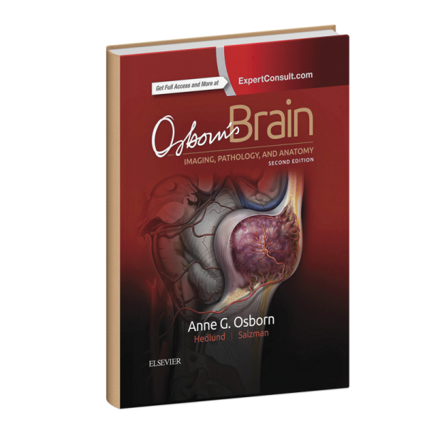 Osborn's brain