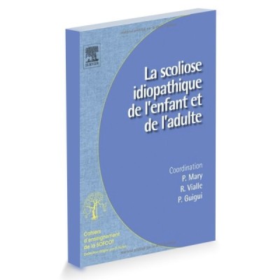 La scoliose idiopathique La scoliose idiopathique