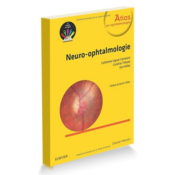 Neuro-ophtalmologie