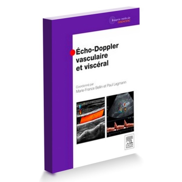 Echo-Doppler vasculaire et viscéral
