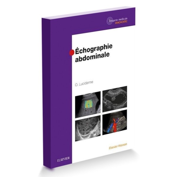 Echographie abdominale