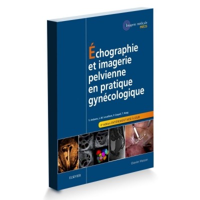 Échographie et imagerie pelvienne en pratique gynécologique Échographie et imagerie pelvienne en pratique gynécologique