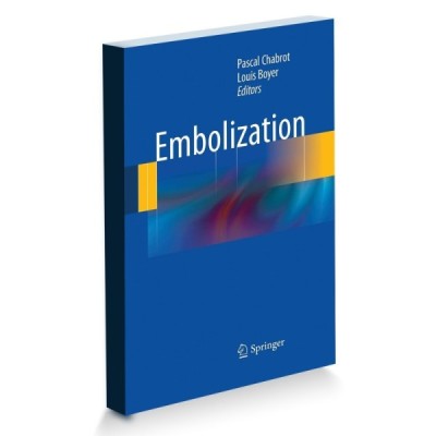 Embolisation