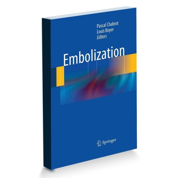 Embolisation