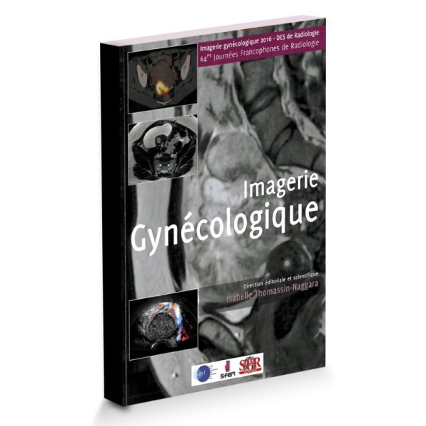 Imagerie gynécologique