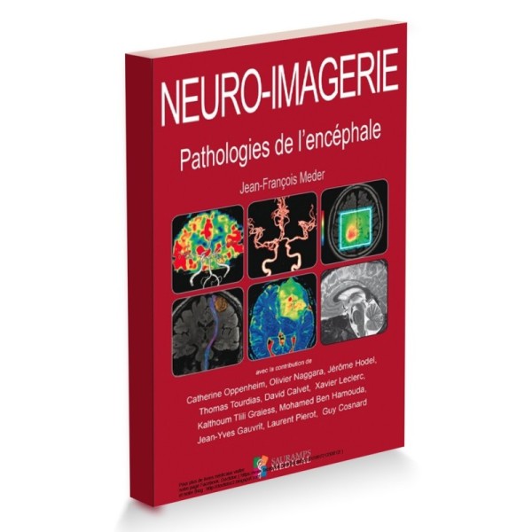 Neuro imagerie
