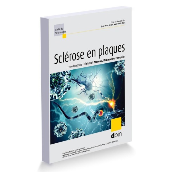 Sclérose en plaques