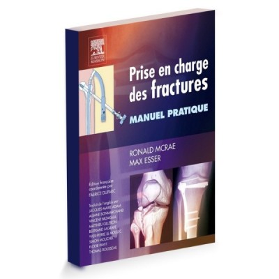 Prise en charge des fractures - Manuel pratique Prise en charge des fractures - Manuel pratique