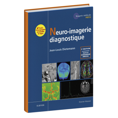 Neuro-imagerie diagnostique