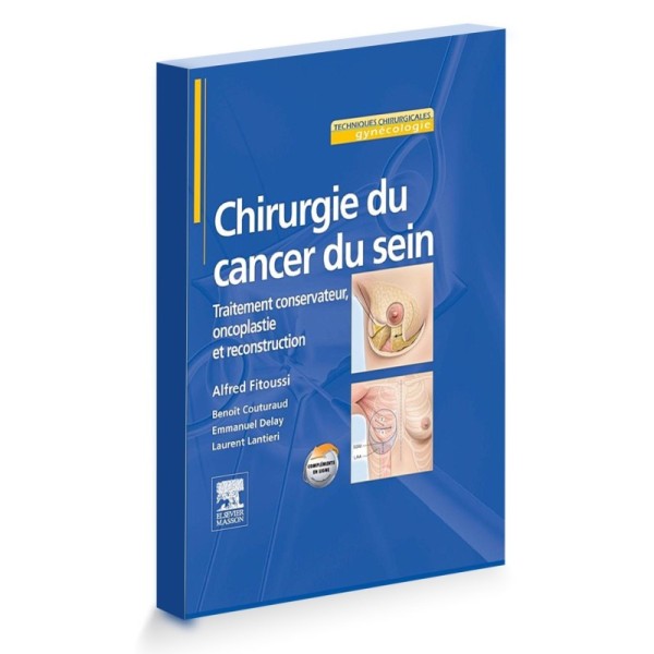 chirurgie du cancer du sein