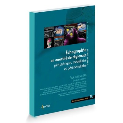 Echographie en anesthésie régionale Echographie en anesthésie régionale