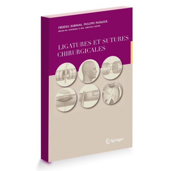 Ligatures et sutures chirurgicales