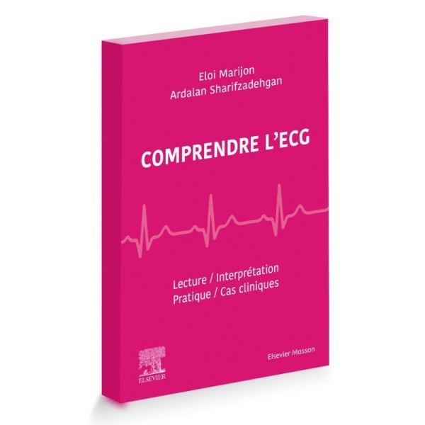Comprendre l'ECG