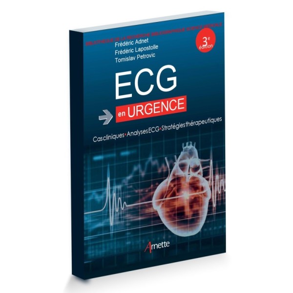 ECG en urgence Cas clinique Analyse ECG Stratégie thérapeutique